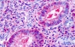 ERR beta/NR3B2 Antibody, Novus Biologicals 50 &mu;g | Buy Online | Novus Biologicals | Fisher Scientific